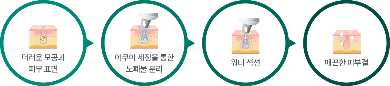 더러운 모공과 피부표면 / 아쿠아 세정을 통한 노폐물 분리 / 워터 석션 / 매끈한 피부결