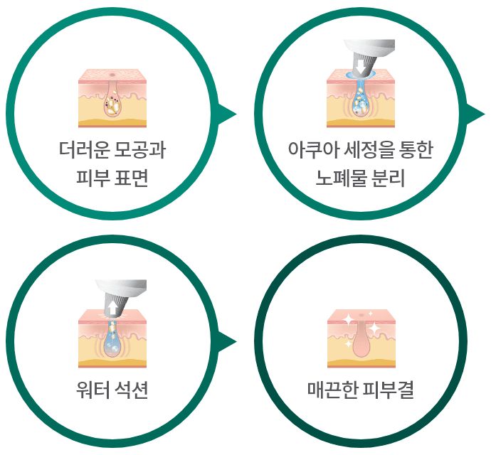 더러운 모공과 피부표면 / 아쿠아 세정을 통한 노폐물 분리 / 워터 석션 / 매끈한 피부결